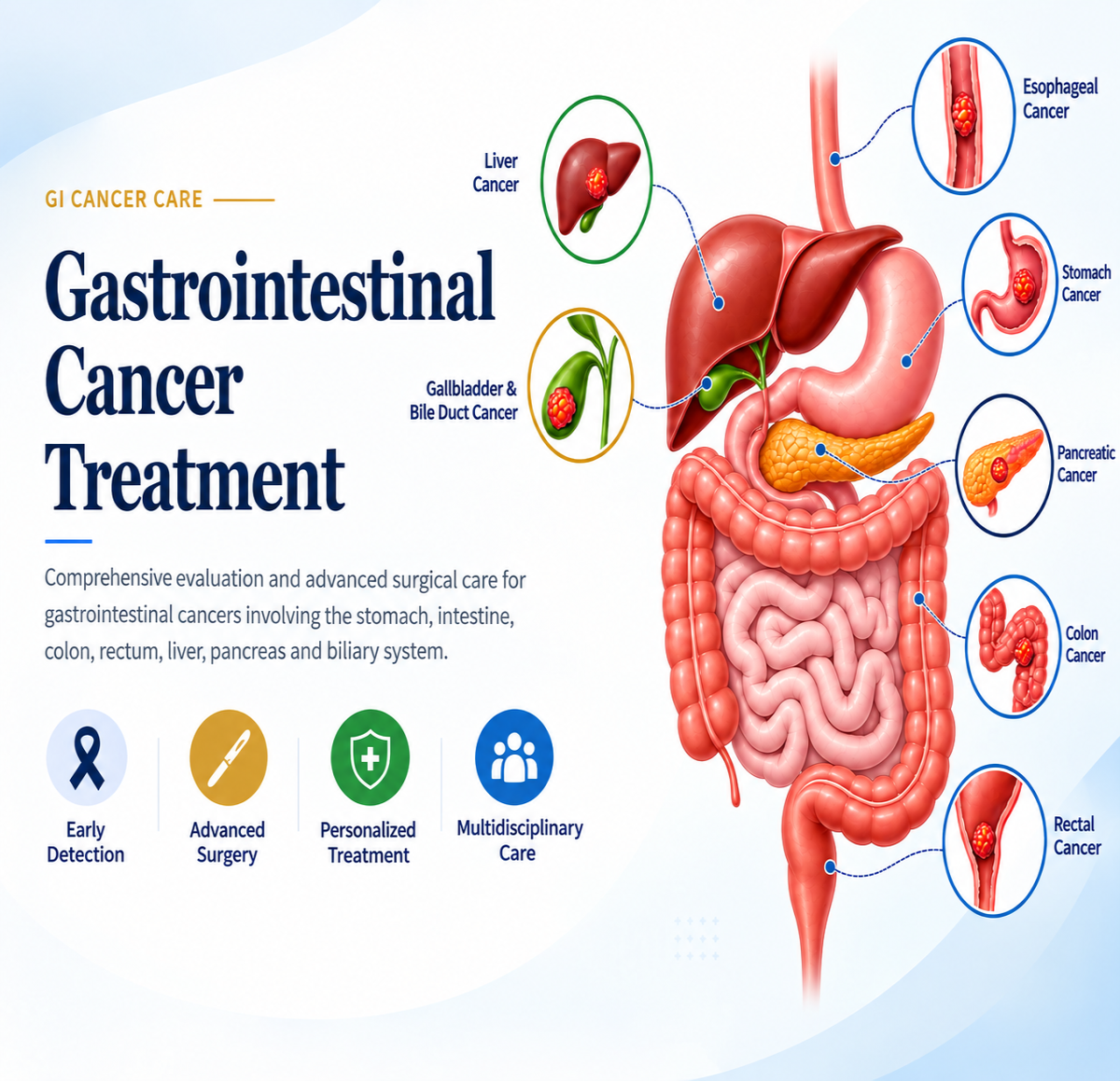 Gastrointestinal cancer treatment and GI oncology care