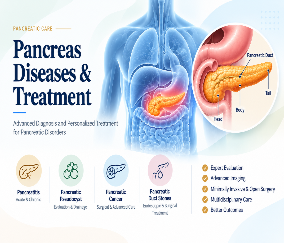 Pancreas diseases and treatment infographic showing pancreatic conditions, diagnosis and treatment options
