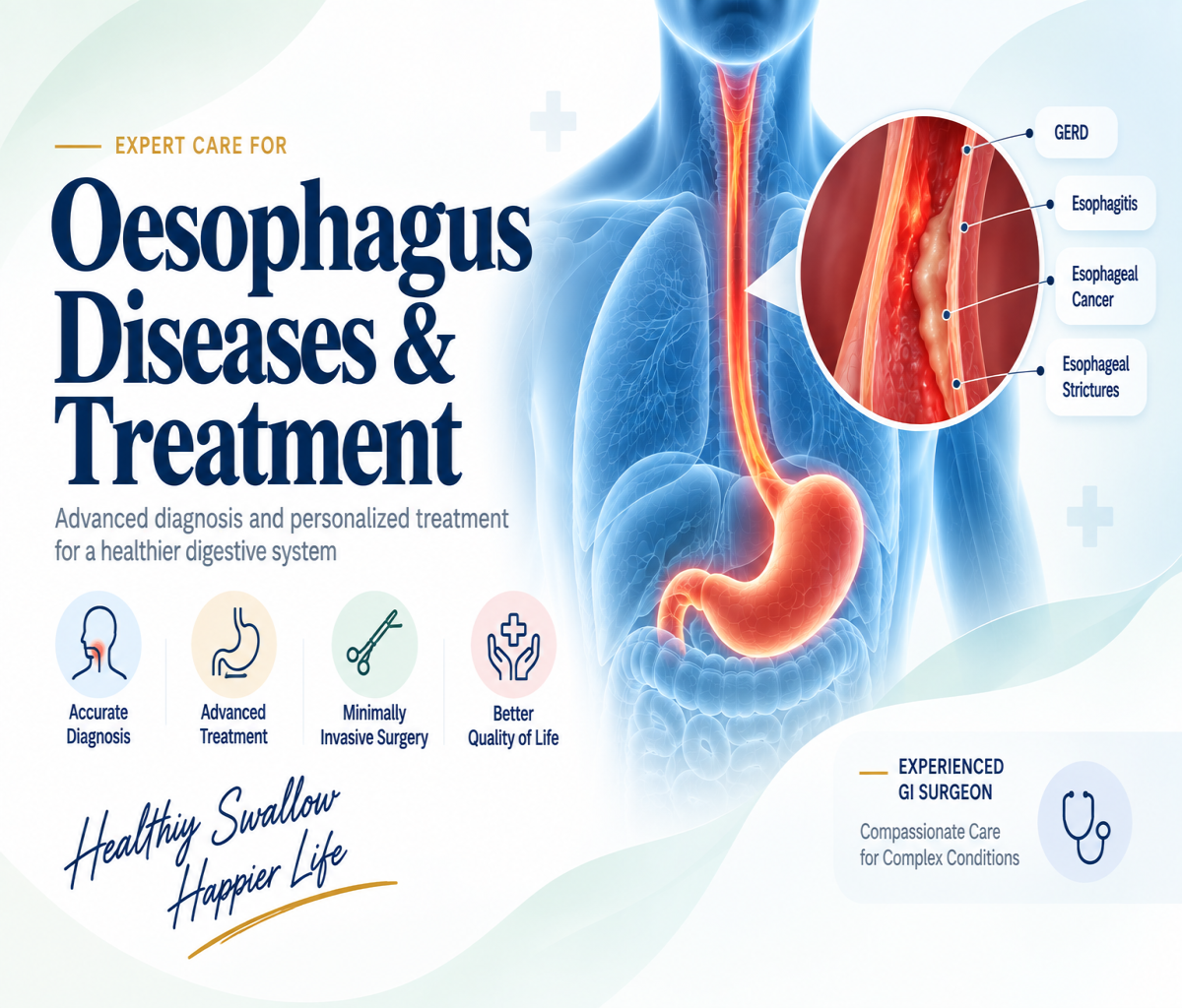 Oesophagus Diseases and Treatment - Expert Esophageal Care