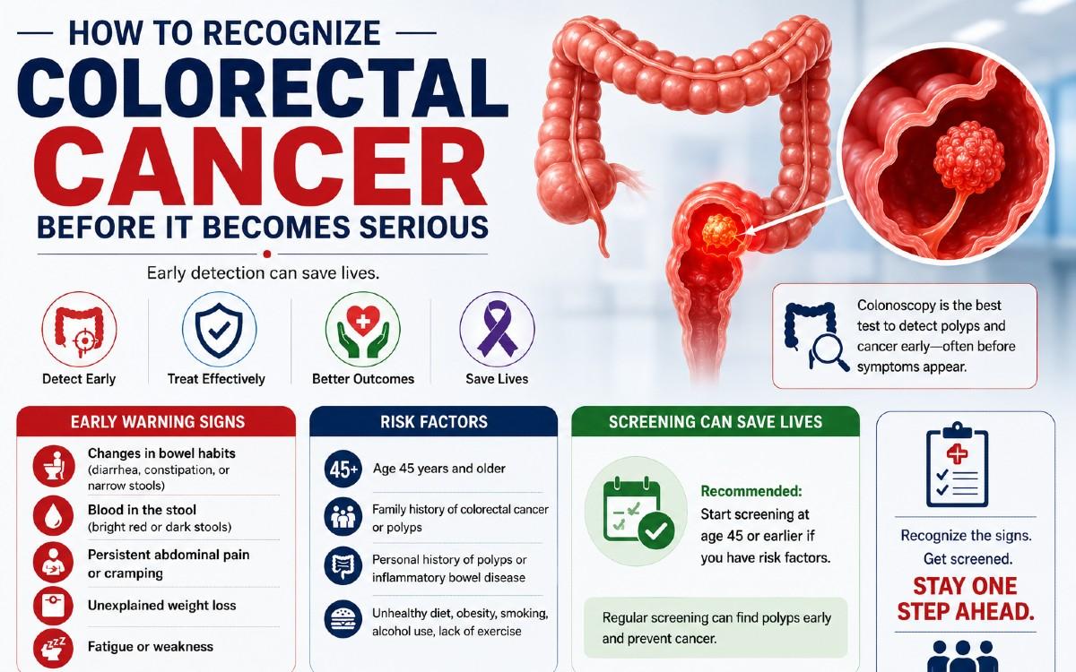 How to Recognize Colorectal Cancer Before It Becomes Serious