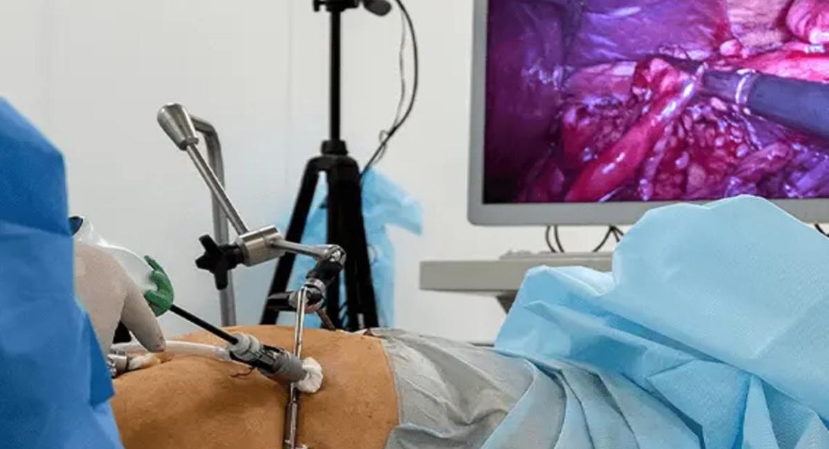 Laparoscopic Surgeon – Understanding Minimally Invasive Surgery and Its Benefits