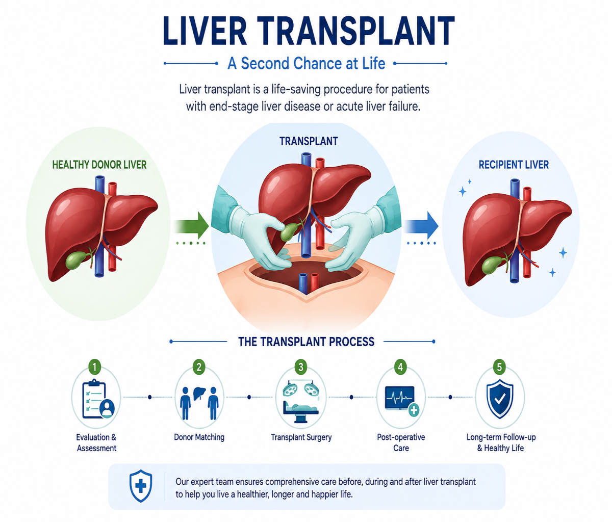 Liver transplant procedure and treatment