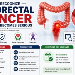 How to Recognize Colorectal Cancer Before It Becomes Serious