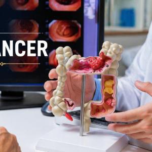 GI Cancer Awareness: Symptoms You Shouldn’t Ignore & Treatment Advances