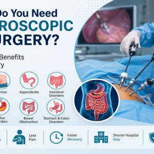 When Do You Need Laparoscopic GI Surgery? Conditions, Benefits and Recovery